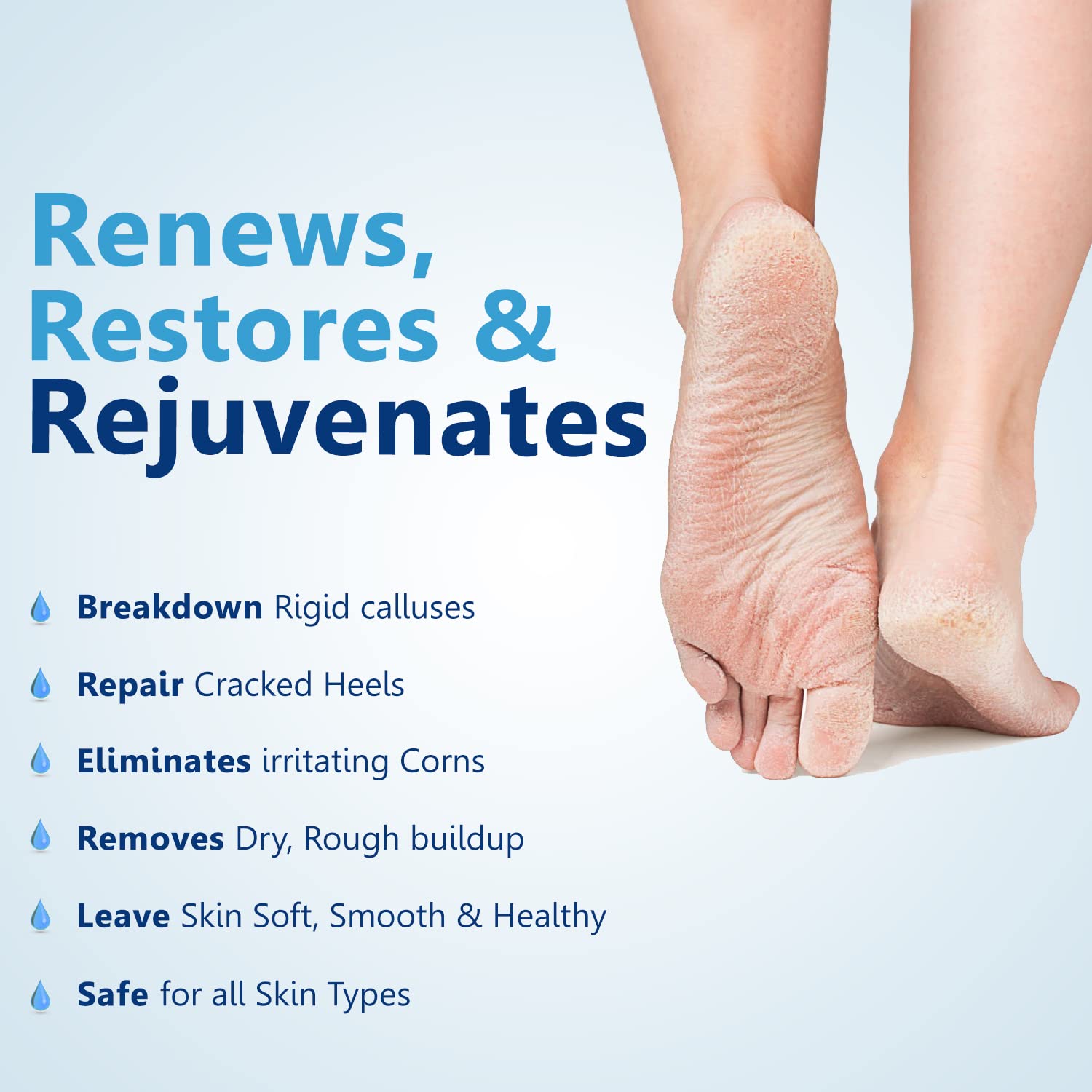 Remedies for Repairing Cracked Heels