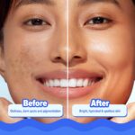 Aqualogica Bright+ Hydra Gel Moisturizer with Blueberry & Kojic Acid - 200 g | 24-Hour Intense Hydration | Water-Like Gel Texture | Makes Skin Bright & Spotless | For All Skin Types - Image 6